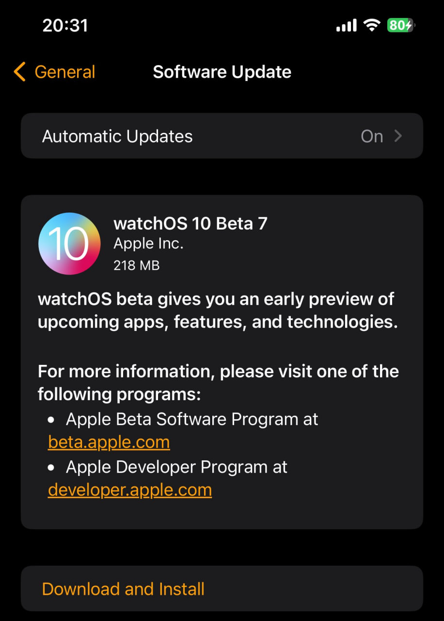 Apple watchOS 10 Beta 7